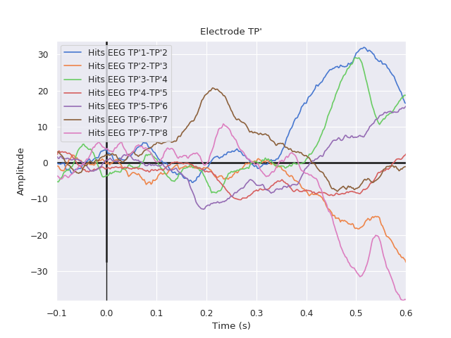 ../../_images/sphx_glr_plot_erp_example_003.png